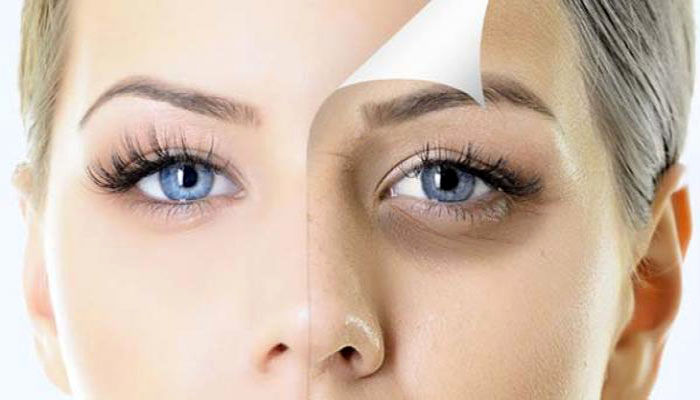 یک ماسک عالی با سیب زمینی برای سیاهی دور چشم یک ماسک عالی با سیب زمینی برای سیاهی دور چشم