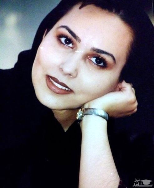 عکس لورفته از پرستو صالحی قبل از عمل زیبایی + عکس عکس لورفته از پرستو صالحی قبل از عمل زیبایی + عکس